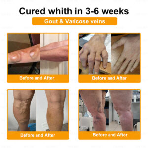 XRLXRL® Bee-Venom Pain-Relief Bone Healing Cream