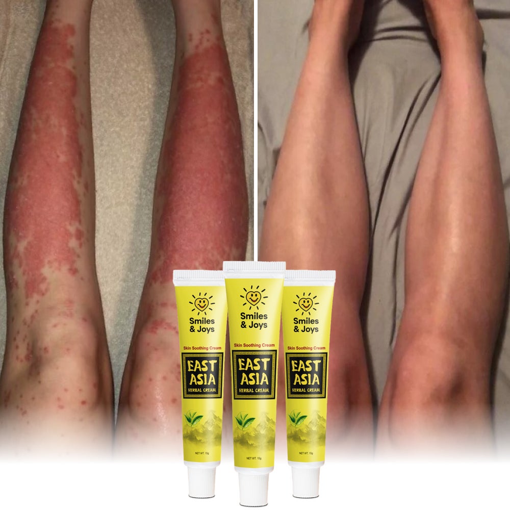 Smiles & Joys Treat Eczema And Psoriasis Naturally