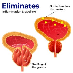 Medilisk Prostate Treatment Cream