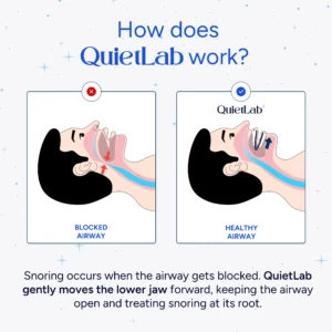 QuietLab Pro® Adjustable Anti-Snoring Mouthpiece