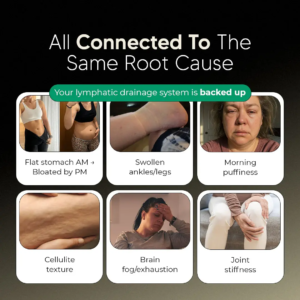SwellEase™ Lymphatic Drainage | Reduces swelling and fluid retention by 93% in just 5 days