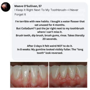 CollaGum™ | Smile Strengthening Collagen Powder!