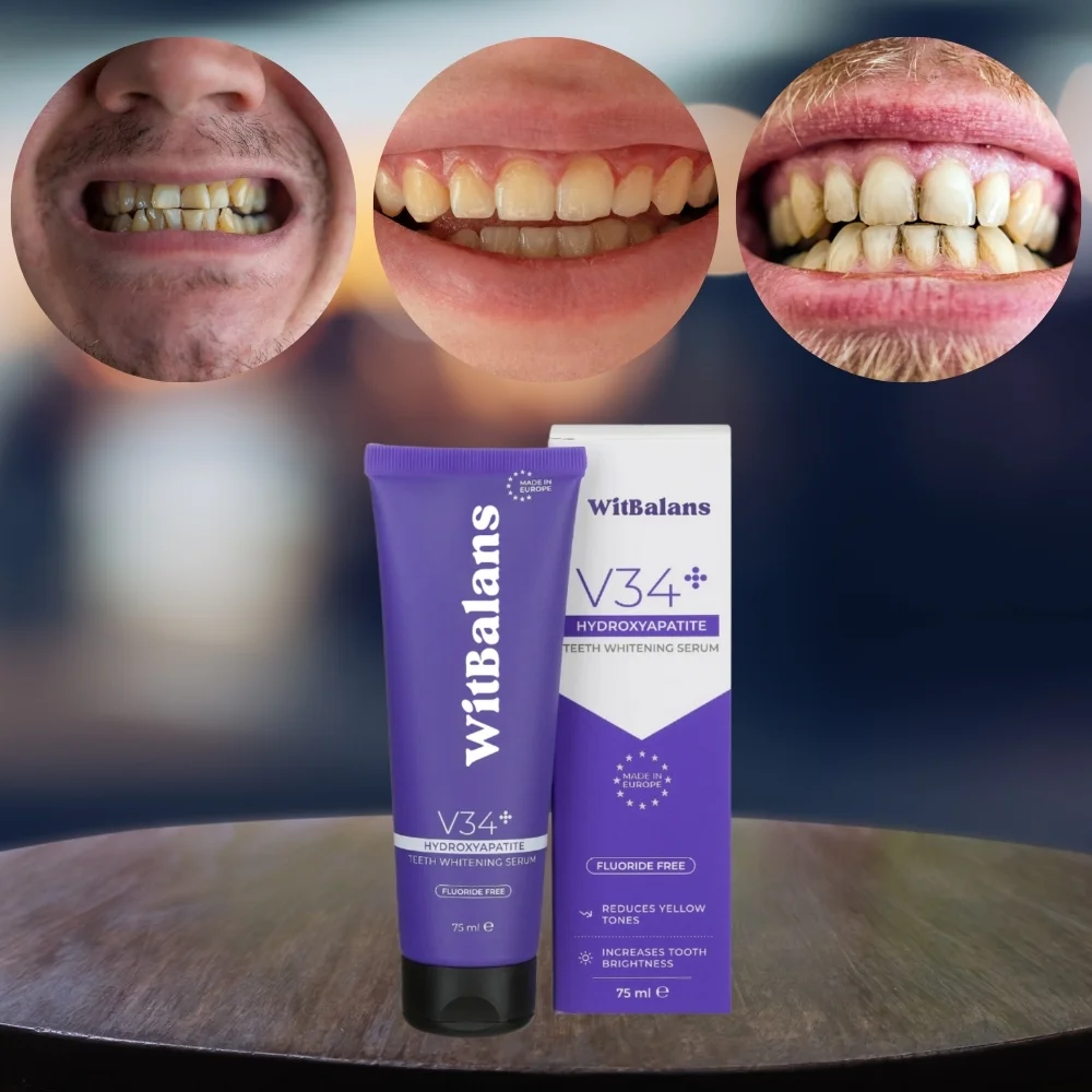 WitBalans™ V34 Toothpaste | Whitens teeth in 60 seconds