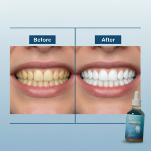 Vitalchemy | Dentite Tooth Armor