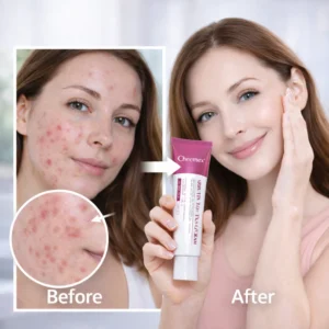 Cheemex™ Brightening Beauty Cream