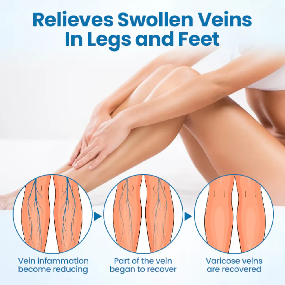 NovaRX® VeinGuard Herbal Spray