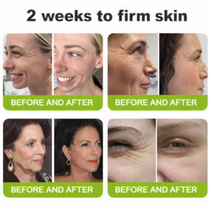 LBMLBM® Botox & Vita-A Retinol Shot Wrinkle-Lift Tightening cream