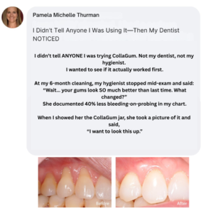 Valverdo CollaGum™ Smile Strengthening Collagen Powder Don't Just Take Our Word For It Why Your Gums Need Collagen Your gums are made mostly of collagen — it’s what keeps them firm and healthy. Over time, brushing, stress, and aging can break down that collagen, causing gums to pull back and teeth to look longer. Regular toothpaste only cleans the surface, and collagen pills focus on skin and joints, not your smile. CollaGum works where it matters most — right at your gumline. When you brush it in, collagen and minerals help rebuild and strengthen your gums, keeping your smile strong and supported every day. 25,000+ Healthier Smiles Real Results. Real Repair. 99% said their gums felt stronger and healthier within 2 weeks. 97% noticed less gum sensitivity and tenderness after daily use. 92% saw a visibly fuller gumline and smoother smile. Frequently Asked Questions CollaGum is a collagen-based powder you brush onto your gums. It helps support gum repair, strength, and comfort — right where your smile needs it most. Your gums are made mostly of collagen. Over time, brushing, stress, and aging can break that collagen down. CollaGum delivers fresh collagen and minerals directly to your gums as you brush, helping to rebuild and strengthen the tissue. After brushing your teeth, dip your damp toothbrush into the CollaGum powder. Gently brush it onto your gums and along the gumline for 20–30 seconds, then rinse or leave it on overnight — whichever you prefer.  CollaGum supports gum health but doesn’t replace good dental care. Keep brushing, flossing, and visiting your dentist as usual for the best results.  Use your normal toothpaste first, then apply CollaGum right after. It’s designed to fit easily into your regular brushing routine.