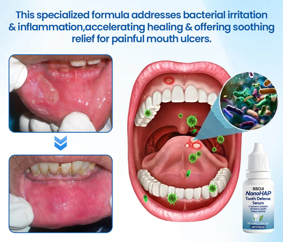 BBOJI NanoHAP Tooth Defense Serum