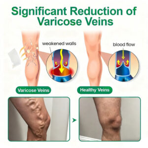 Healrize® VeinTarget Microneedle Patch