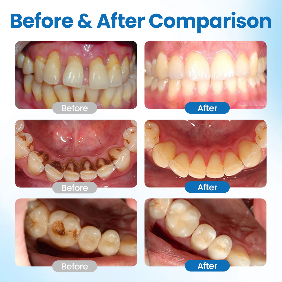 TAILEDEN™ Tooth Defense Serum