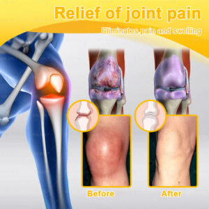XRLXRL® Bee-Venom Pain-Relief Bone Healing Cream