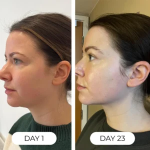 Nature's Roots Lymphatic Drops