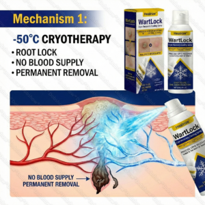 Healrize® WartLock Cryo-Recovery Cooling Spray