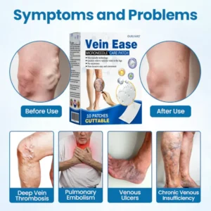 Ourlyard® Vein Ease Microneedle Care Patch – Cuttable