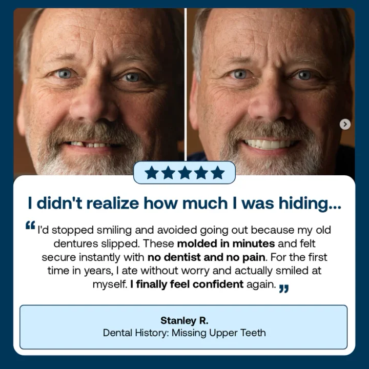 BQYOOMTM Custom-Fit Fully Functional Dentures