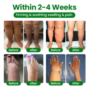 LAOZIK™ VenoSoothe Leg Relief Spray