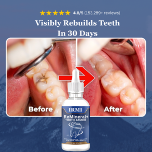 IRMI Advanced Tooth Armor Dentite