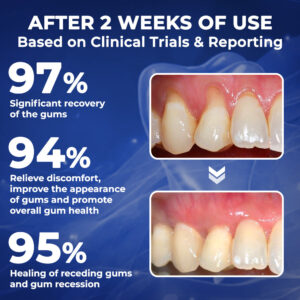 Rolimey® BeeTakt Bee Venom Dental Treatment Drops Mouthwash