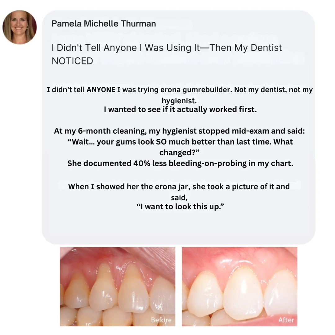 Erona Collagen Gum-GumRebuilder Collagen Powder