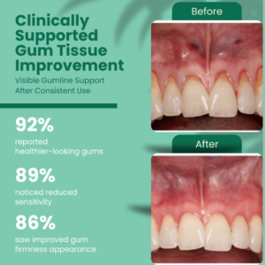 Erona Collagen Gum-GumRebuilder Collagen Powder