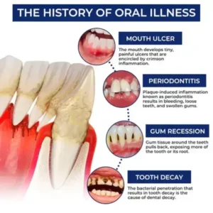 Croaie® ApiGuard BeeVenom Therapeutic Oral Drops and Rinse