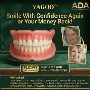 YAGOO™ Custom-Fit Full Functional Dentures