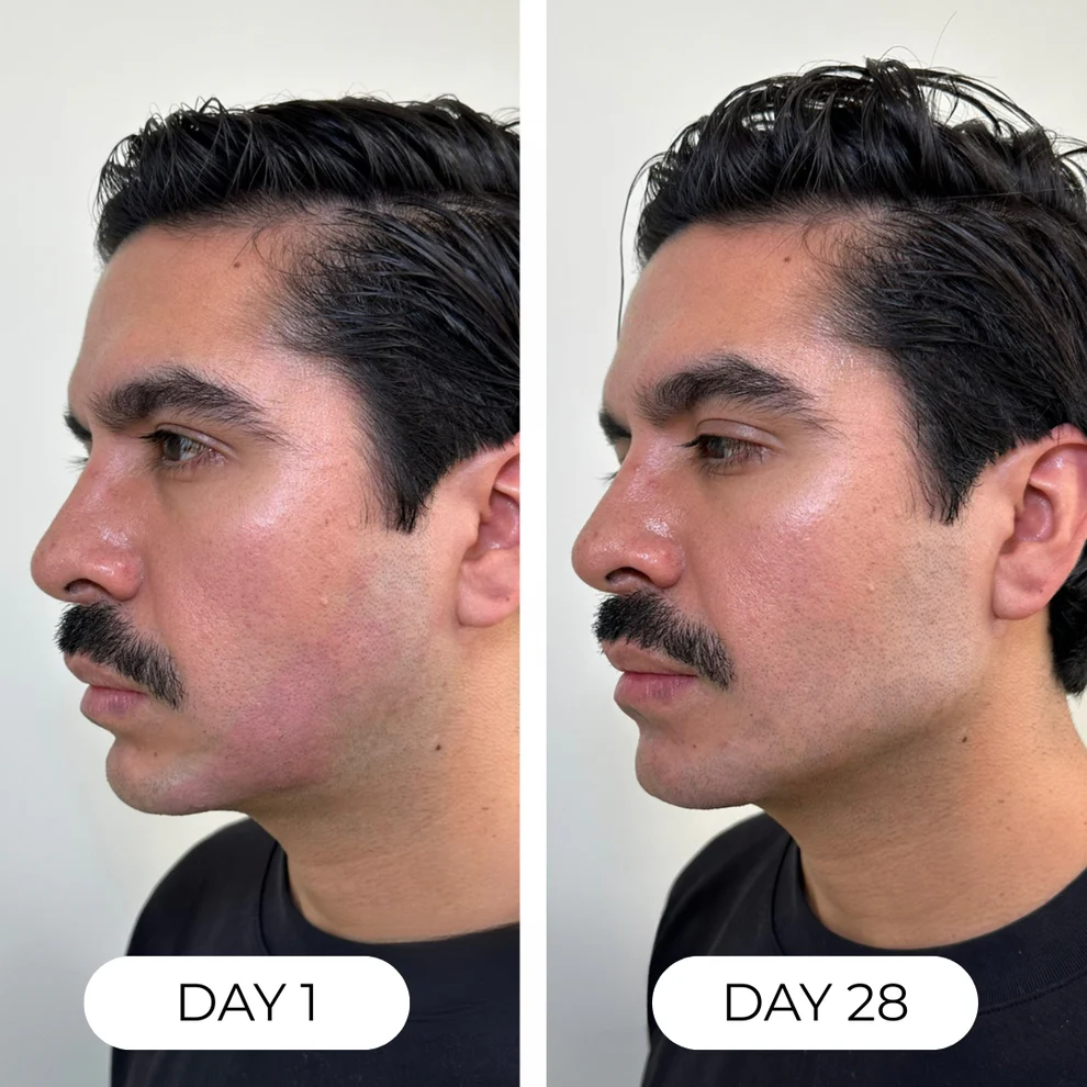 Nature's Roots Lymphatic Drops