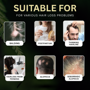 AEXZR® Exosome Bio-Signal Shampoo image AEXZR® Non-Minoxidil Scalp Recovery