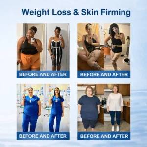 Yoofire Microneedle Patches