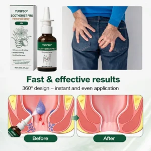YUNPSO® SootheMist PRO Hemorrhoid Spray