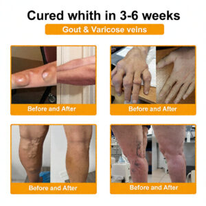 LOVILDS™ Bee Venom Pain-Relief Bone Healing Cream