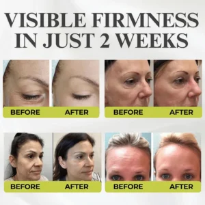 Yunpso® Advanced Peptide Botox-Style + Vita-A Retinol Lifting Renewal Cream