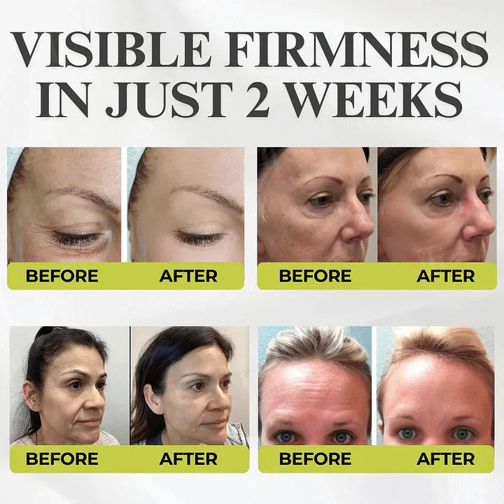 Yunpso® Advanced Peptide Botox-Style + Vita-A Retinol Lifting Renewal Cream