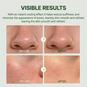 Cactox™ Pore Relief Cactus Balm