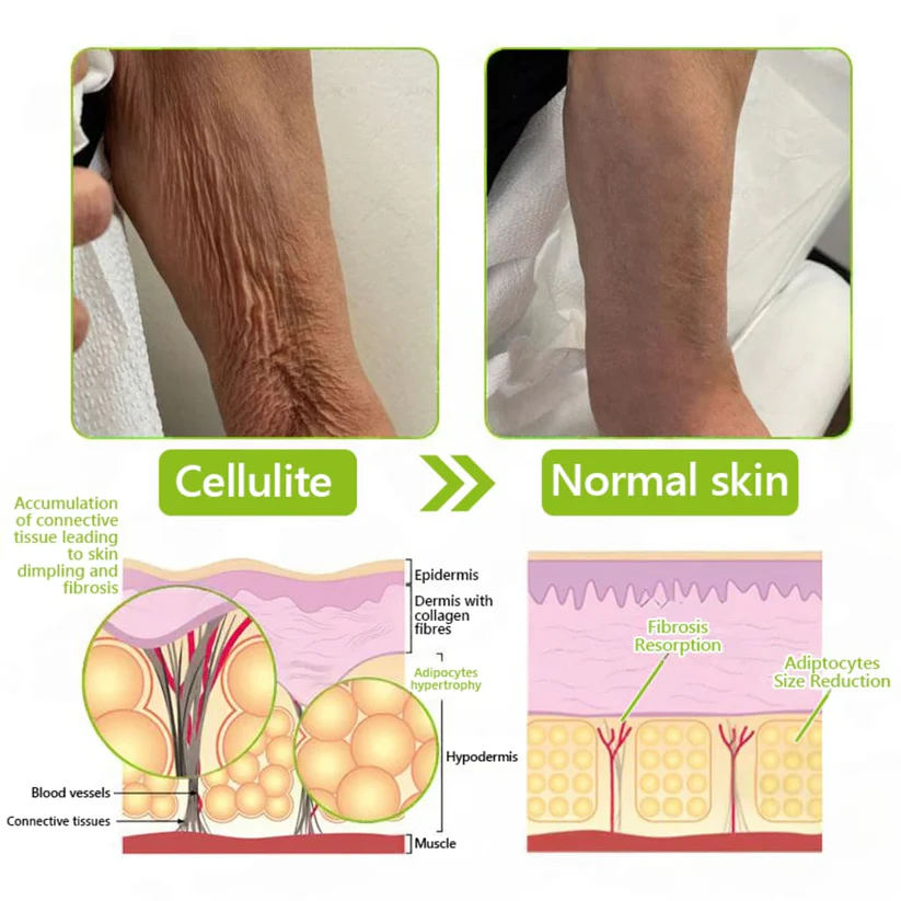 Odalit Botox & Vita-A Retinol Shot Wrinkle-Lift Tightening cream - Image 11