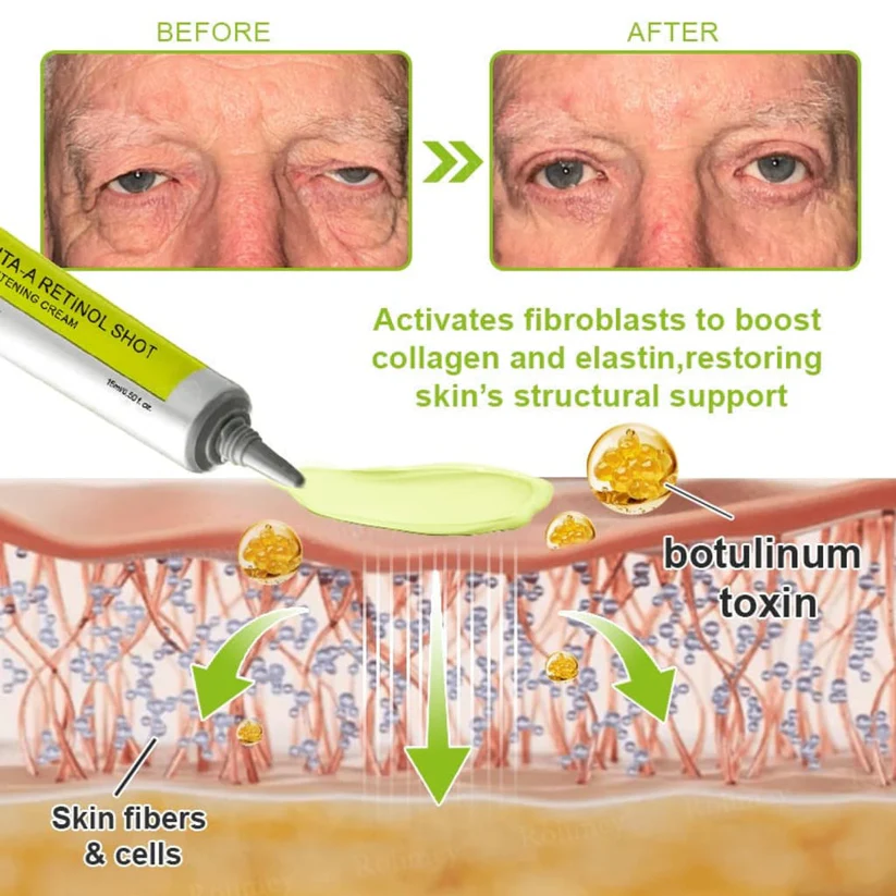 Odalit Botox & Vita-A Retinol Shot Wrinkle-Lift Tightening cream - Image 9