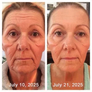 Odalit Botox & Vita-A Retinol Shot Wrinkle-Lift Tightening cream