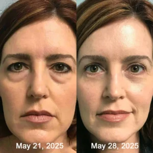 Odalit Botox & Vita-A Retinol Shot Wrinkle-Lift Tightening cream