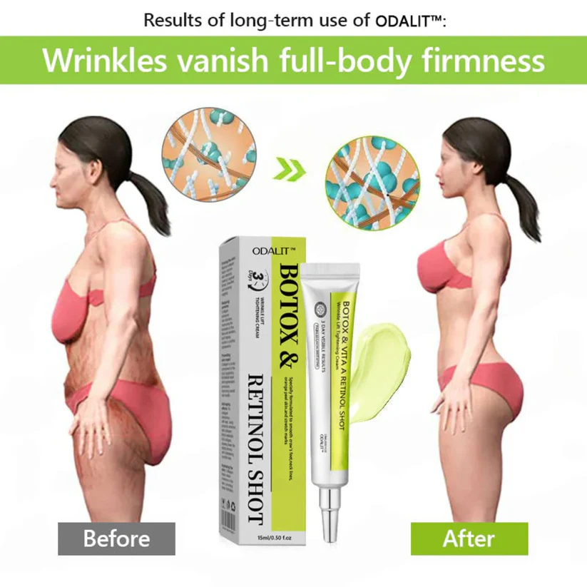 Odalit Botox & Vita-A Retinol Shot Wrinkle-Lift Tightening cream
