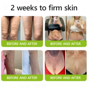 Odalit Botox & Vita-A Retinol Shot Wrinkle-Lift Tightening cream