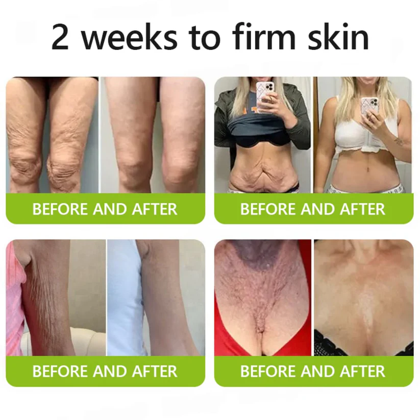 Odalit Botox & Vita-A Retinol Shot Wrinkle-Lift Tightening cream