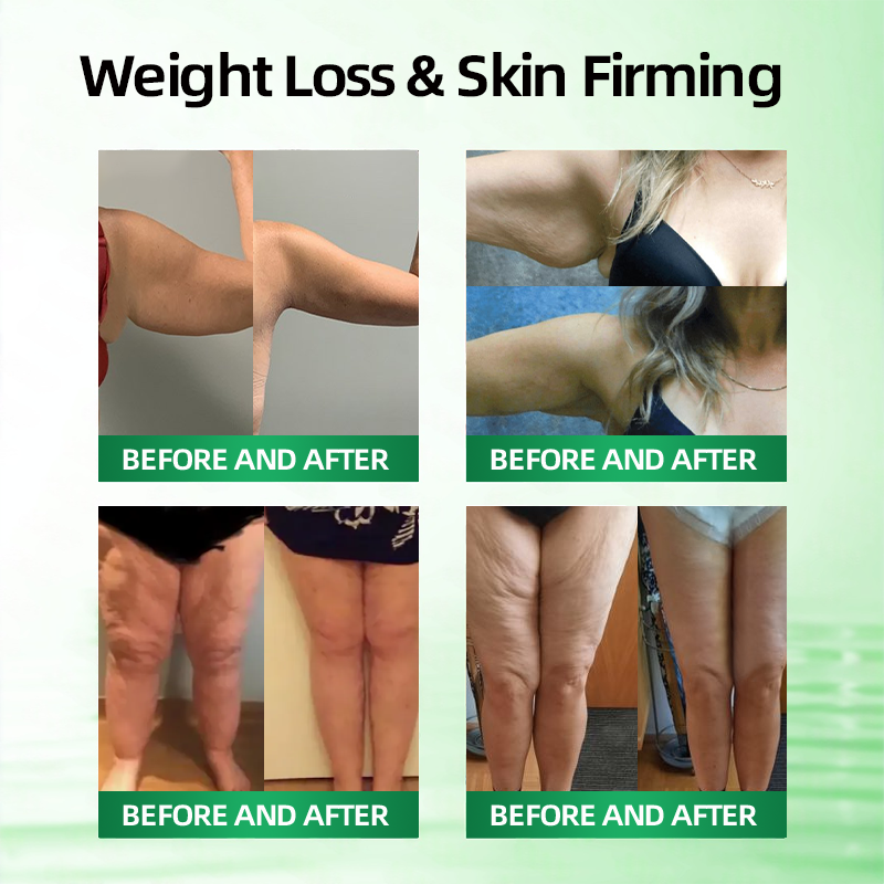 CureVivo® Moringa Bee Venom Berberine NAD+ 10 in 1 Advanced Nano Microneedle Patch image CureVivo® Moringa Bee Venom Berberine NAD+ 10 in 1 Advanced Nano Microneedle Patch