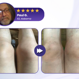 Timilk® Silver Ion Joint Repair Spray