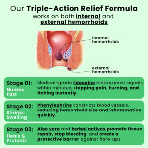 Illura Advanced Hemorrhoid Relief Cream