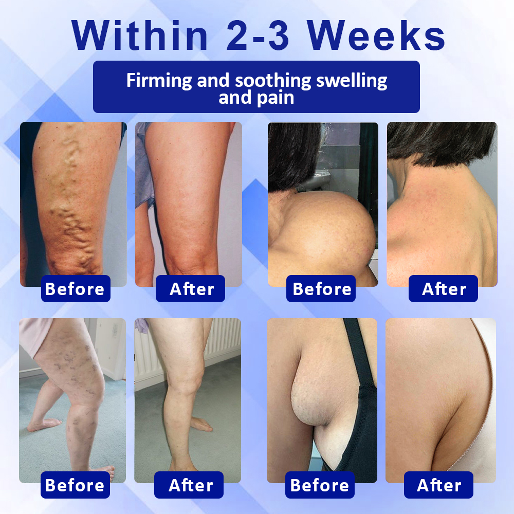 Elycura™ Lymphatic Drainage Massage Cream