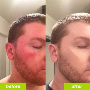 Uvora - Milk Thistle Detox