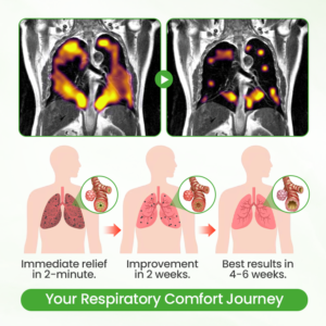 ATTDX® Mulleaf Herbal Lung Purifier