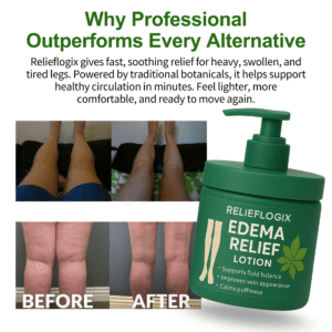 Relieflogix Edema Relief Lotion