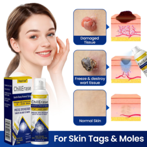 Healrize®ChillErase Gentle Bump Renewal Spray